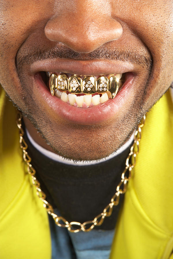 Portrait of young man with gold teeth, close-up Photograph by Baerbel Schmidt