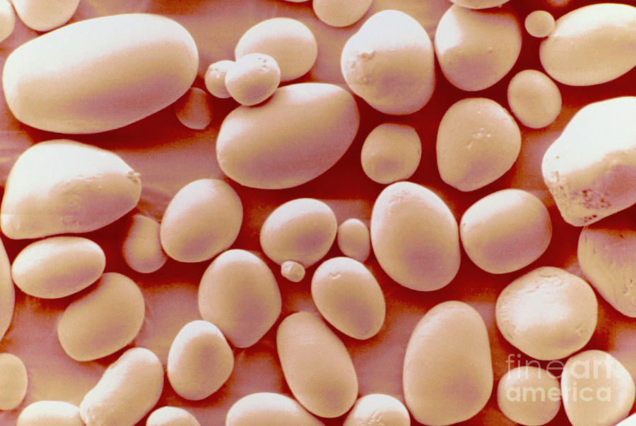 Potato Starch Granules Sem Photograph by Scimat