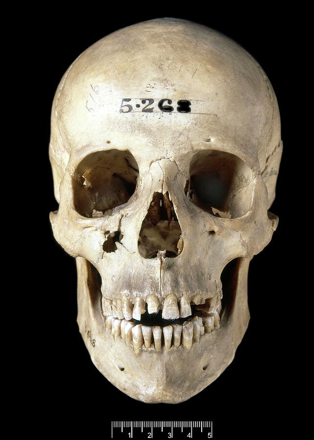 Prehistoric Human Skull Photograph By Natural History Museum London Science Photo Library