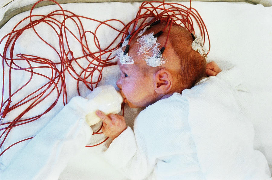 Premature Baby Photograph by Horacio Sormani/science Photo Library