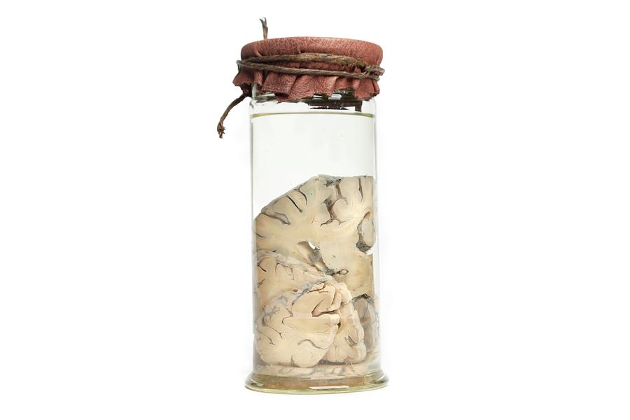 Preserved Brain In Jar Photograph by Gregory Davies