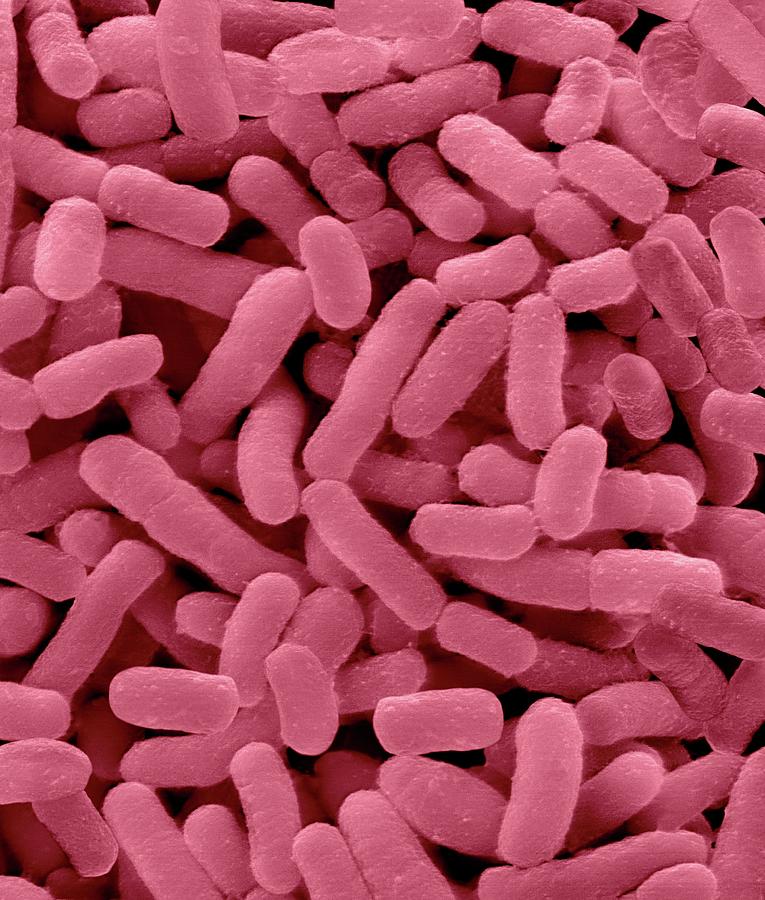 Bacteria Photograph - Prevotella Intermedia by Dennis Kunkel Microscopy/science Photo Library