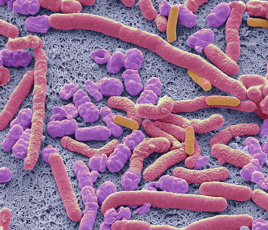 Probiotic Bacteria Photograph by Steve Gschmeissner/science Photo Library