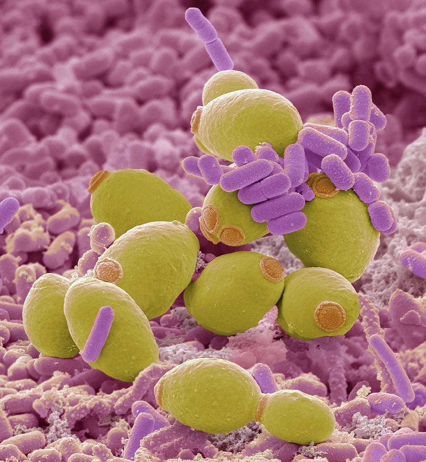 Probiotic Flora by Steve Gschmeissner/science Photo Library