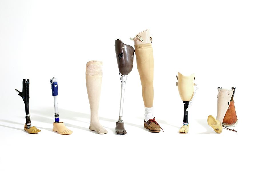 Prosthetic Legs Photograph by Gregory Davies