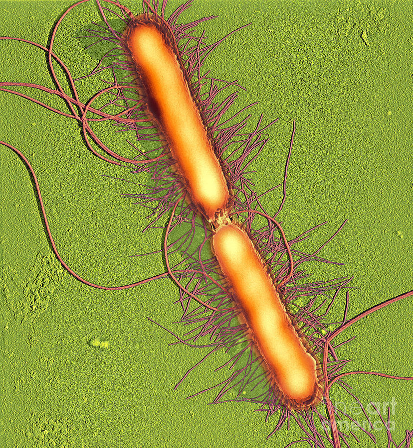 Proteus vulgaris bacteria SEM Photograph by Spl