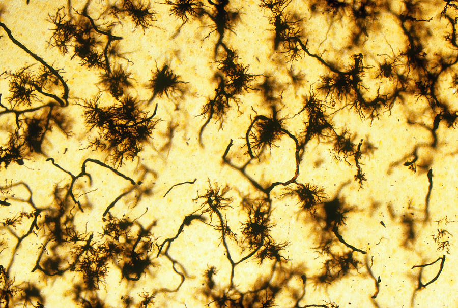 Protoplasmic Astrocytes, Lm Photograph by Michael Abbey