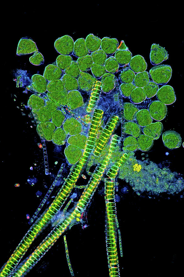 Protozoa And Desmids Photograph by Marek Mis