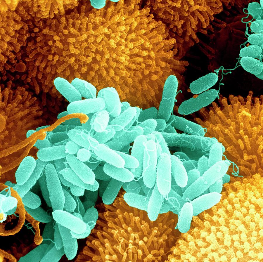 Pseudomonas Aeruginosa Bacteria Photograph By Science Photo Library Hot Sex Picture