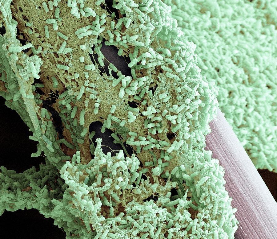 Pseudomonas Aeruginosa Bacteria Photograph by Science Photo Library