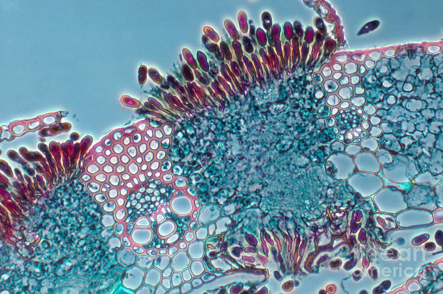 Puccinia Graminis, Fungus Photograph by Robert Knauft / Biology Pics