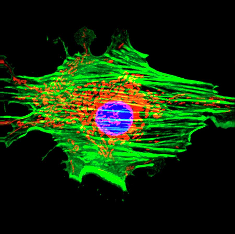 Pulmonary Artery Cell Photograph by R. Bick, B. Poindexter, Ut Medical School/science Photo Library