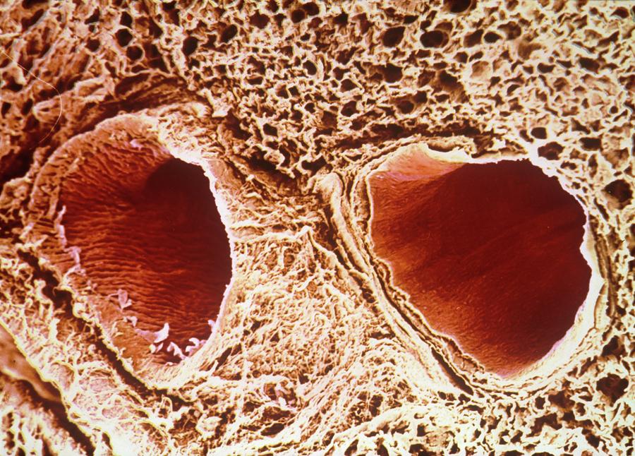 Pulmonary Vein And Artery Photograph by Pir/cnri