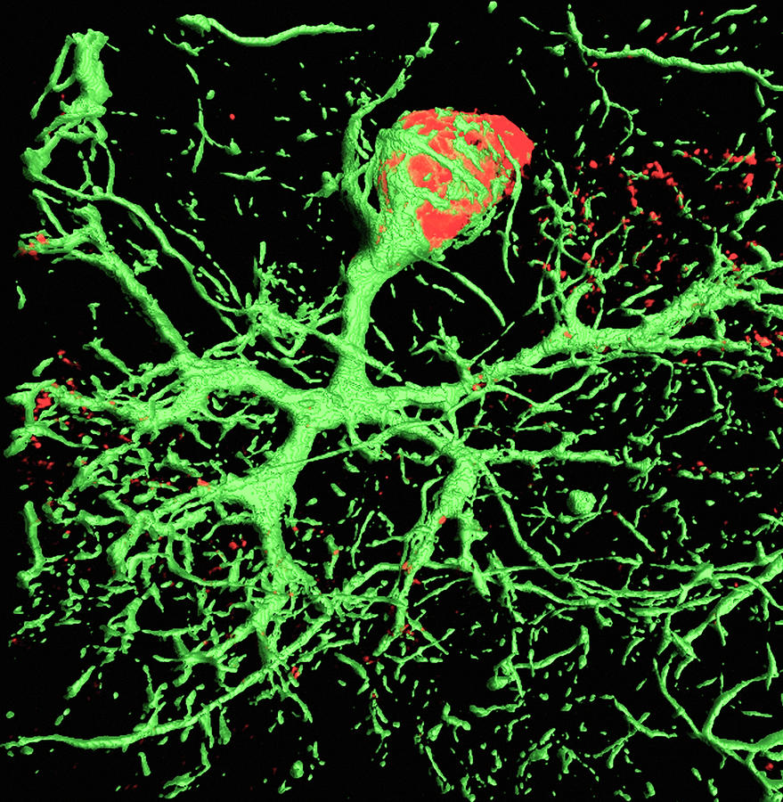 Purkinje Nerve Cell Photograph by C.j.guerin, Phd, Mrc Toxicology Unit/ Science Photo Library