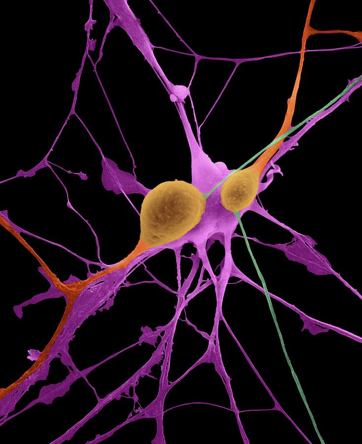 Pyramidal Neurons From Cns Photograph by Dennis Kunkel Microscopy/science Photo Library