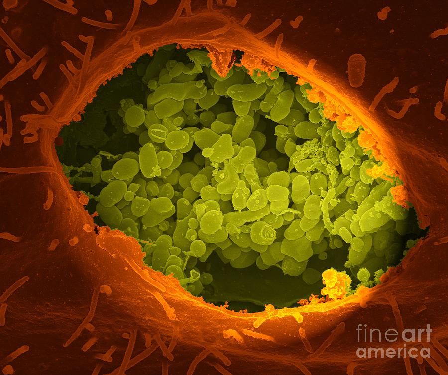 Vero Cell Photograph - Q Fever Bacteria, Sem by Niaid