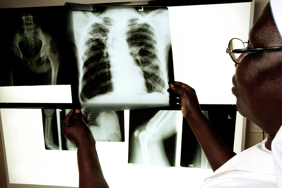 Radiographer Looking At X-rays Photograph by Mauro Fermariello/science Photo Library