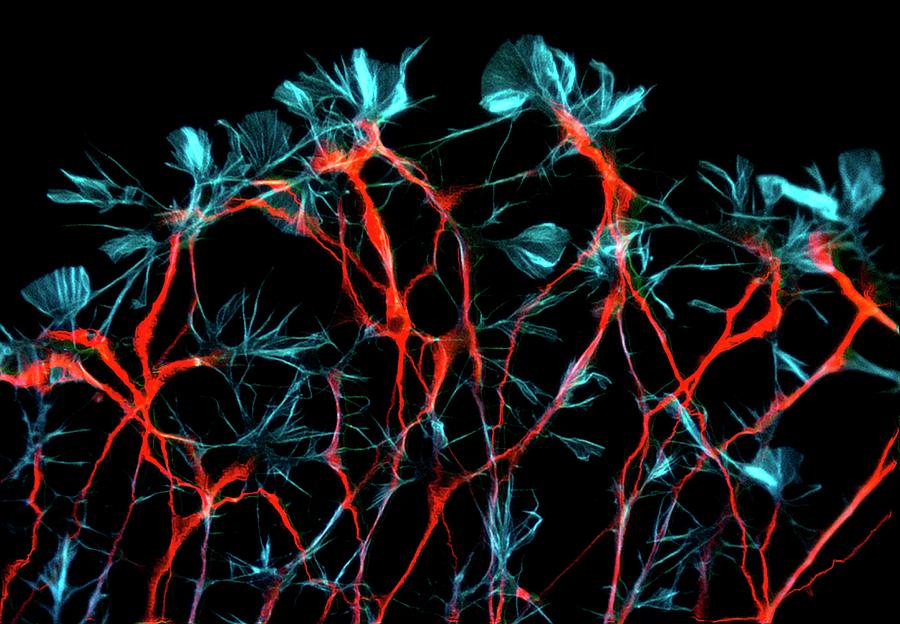 Rat Neurons Photograph by Heiti Paves/science Photo Library