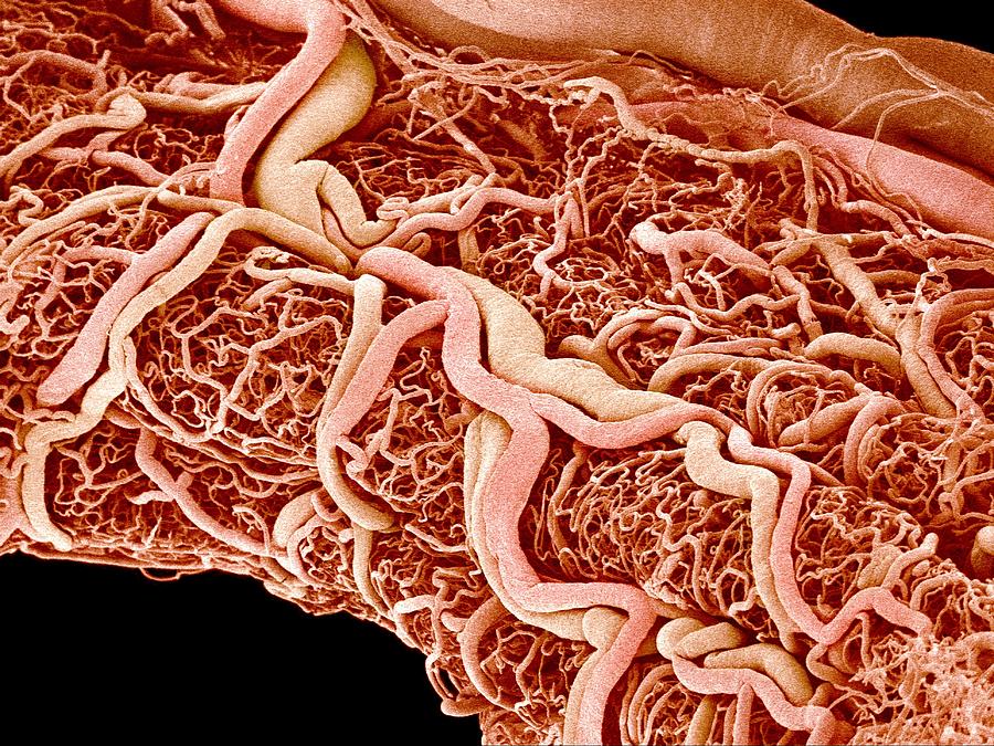 Rectal Blood Vessels Photograph by Susumu Nishinaga