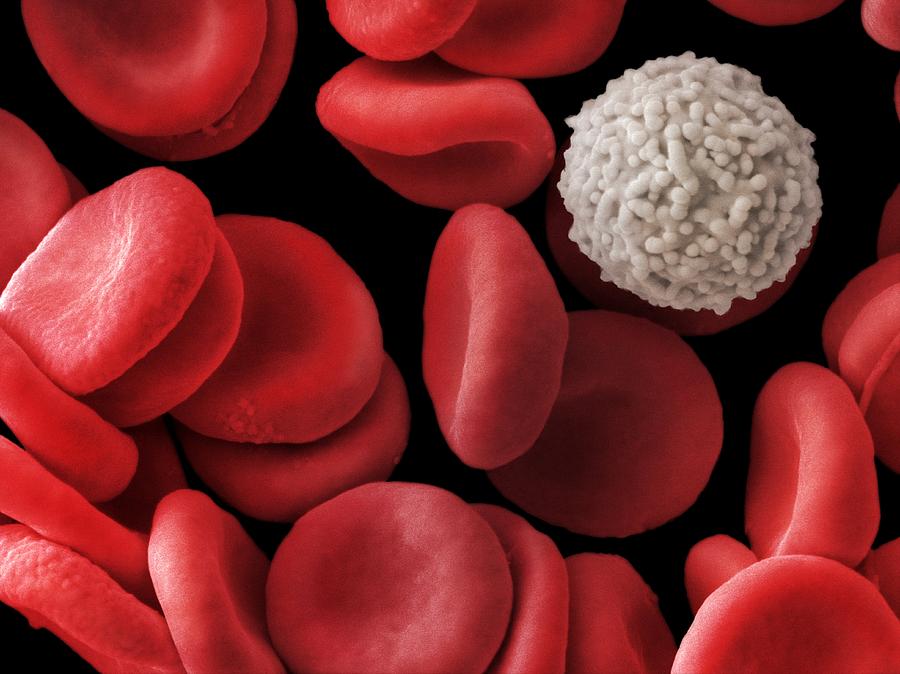 Blood Photograph - Red And White Blood Cells, Sem by Power And Syred