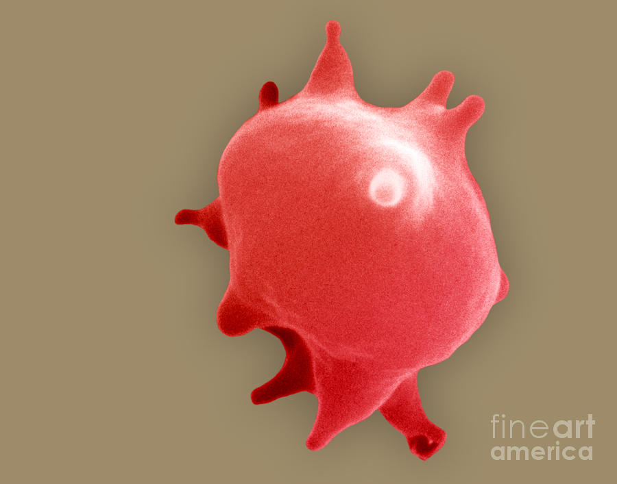 Red Blood Cell In Hypertonic Solution Photograph by David M. Phillips