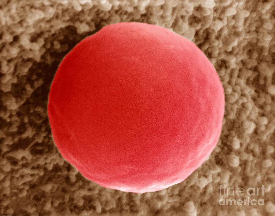 Red Blood Cell In Hypotonic Solution Photograph by David M. Phillips