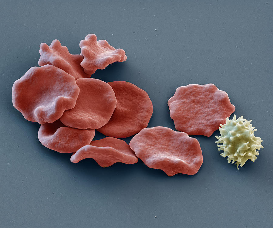 Red Blood Cells And Lymphocyte, Sem Photograph by Eye of Science