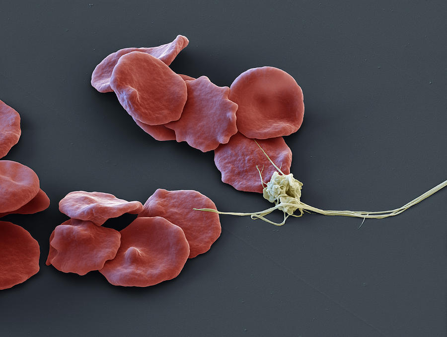 Red Blood Cells And Platelet, Sem Photograph by Eye of Science