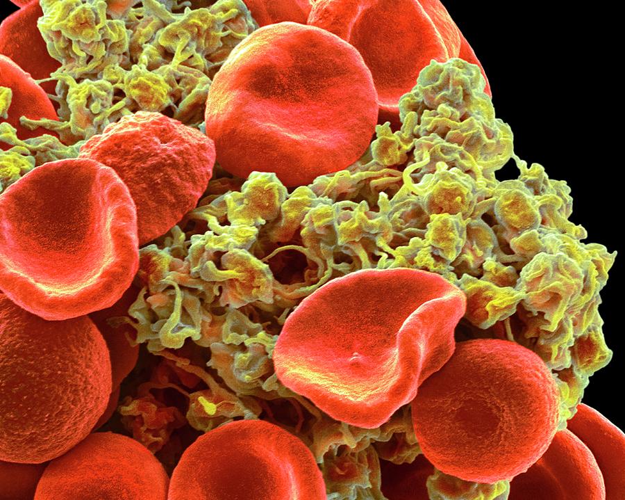 red-blood-cells-and-platelets-photograph-by-steve-gschmeissner-pixels