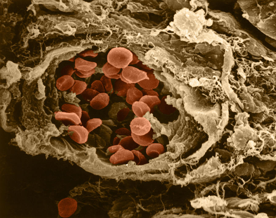 Red Blood Cells, Collagen Fibers, Sem Photograph by Joseph F. Gennaro Jr.