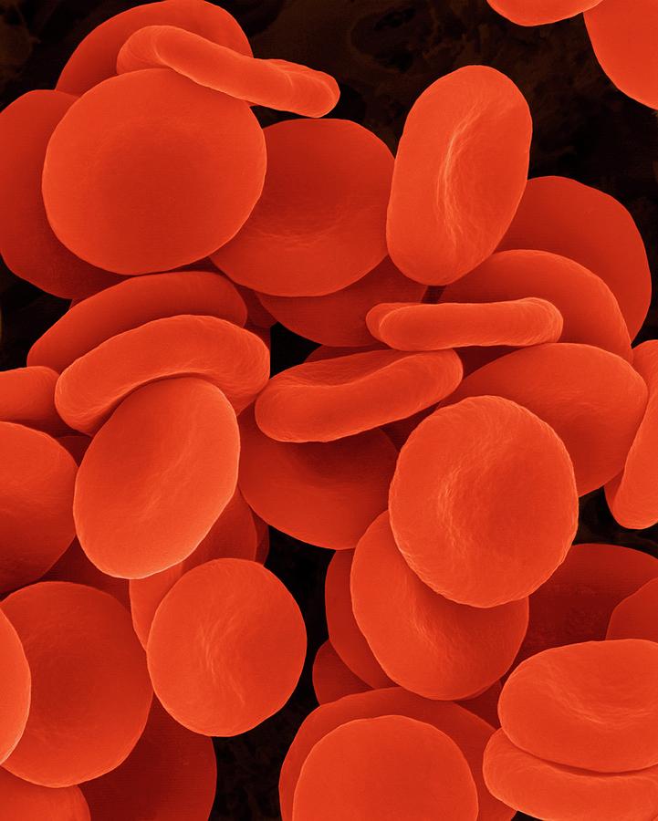 Red Blood Cells In Isotonic Solution Photograph by Dennis Kunkel Microscopy/science Photo Library