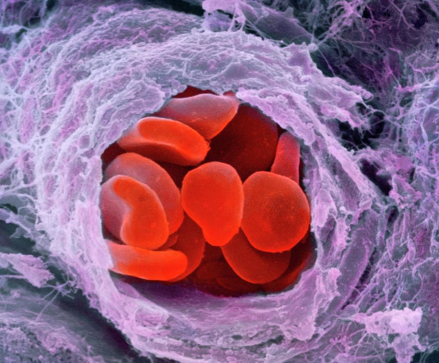 Red Blood Cells Photograph by Professors P.m. Motta & S. Correr