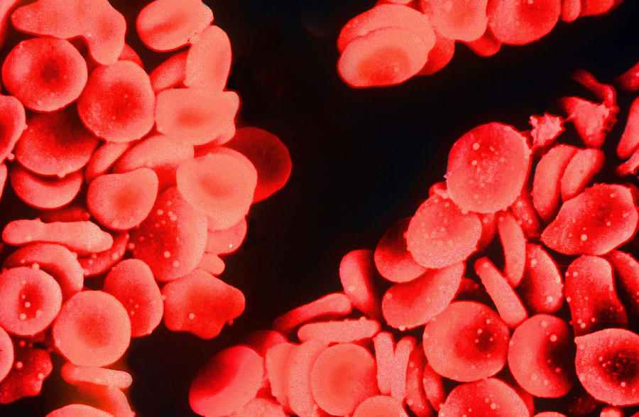 Red Blood Cells, Sem Photograph by Marshall Sklar