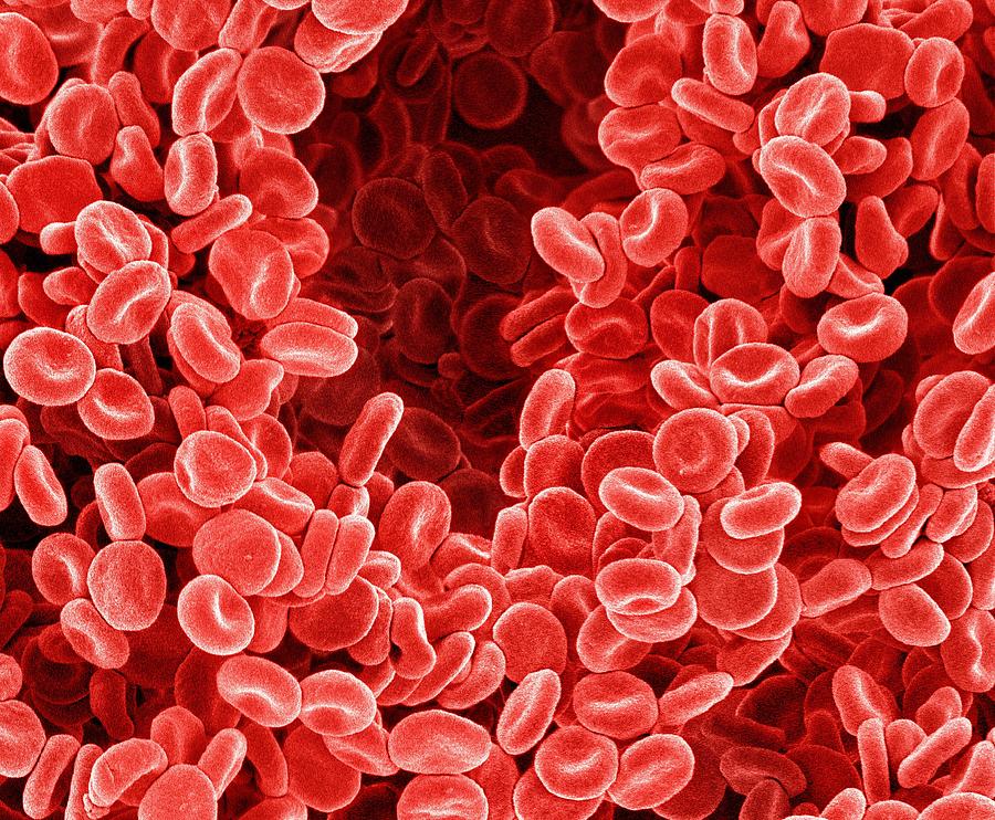 Red Blood Cell Photograph - Red blood cells, SEM by Science Photo Library