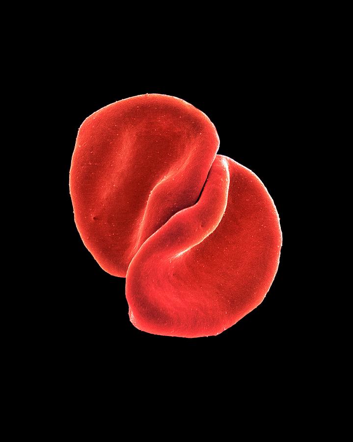 Red Blood Cells Photograph by Steve Gschmeissner