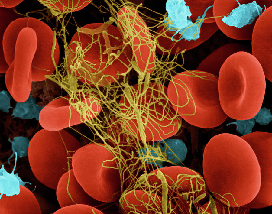 Red Blood Cells Photograph By Dennis Kunkel Microscopy Science Photo My Xxx Hot Girl