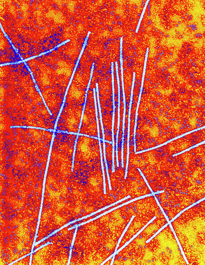 Red Clover Vein Mosaic Virus Photograph by Centre For Bioimaging, Rothamsted Research/science Photo Library
