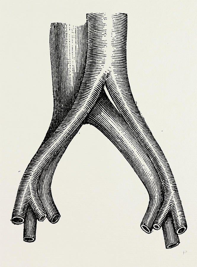 Relation Of Veins, Medical Equipment, Surgical Instrument Drawing by