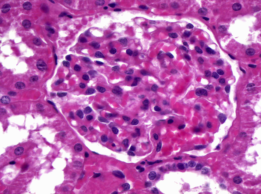 Renal Corpuscle, Lm Photograph by Alvin Telser
