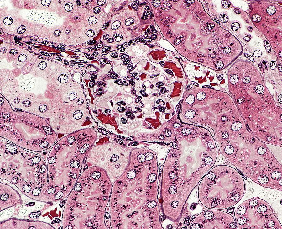 Renal Corpuscle Photograph by Microscape