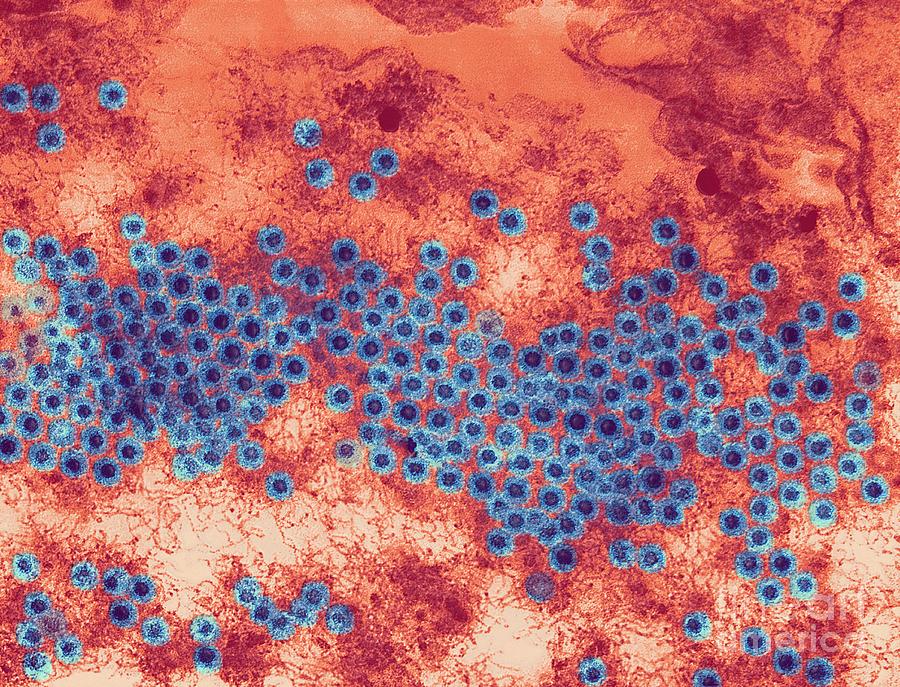 Reovirus Particles, Tem by Science Photo Library