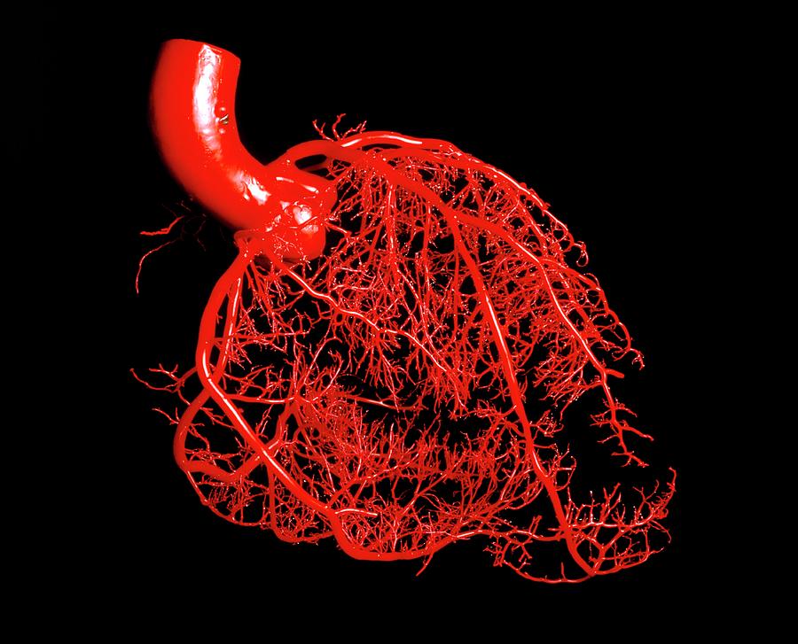 Resin Cast Of The Coronary Arteries Of The Heart Photograph by Martin Dohrn/royal College Of Surgeons/ Science Photo Library.