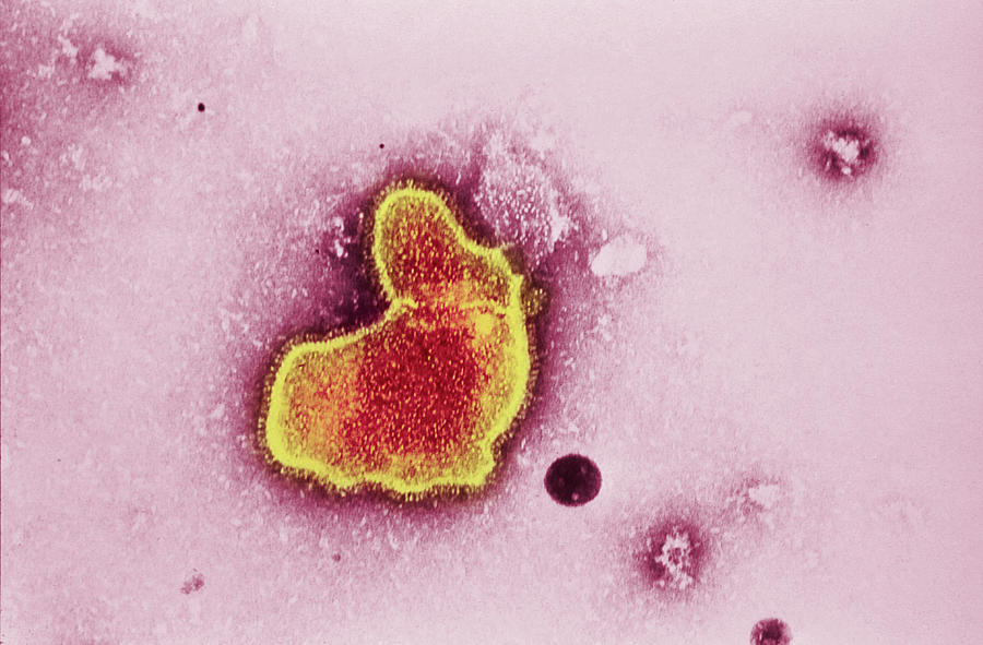 Paramyxovirus Photograph - Respiratory Syncytial Virus by Cdc/science Photo Library