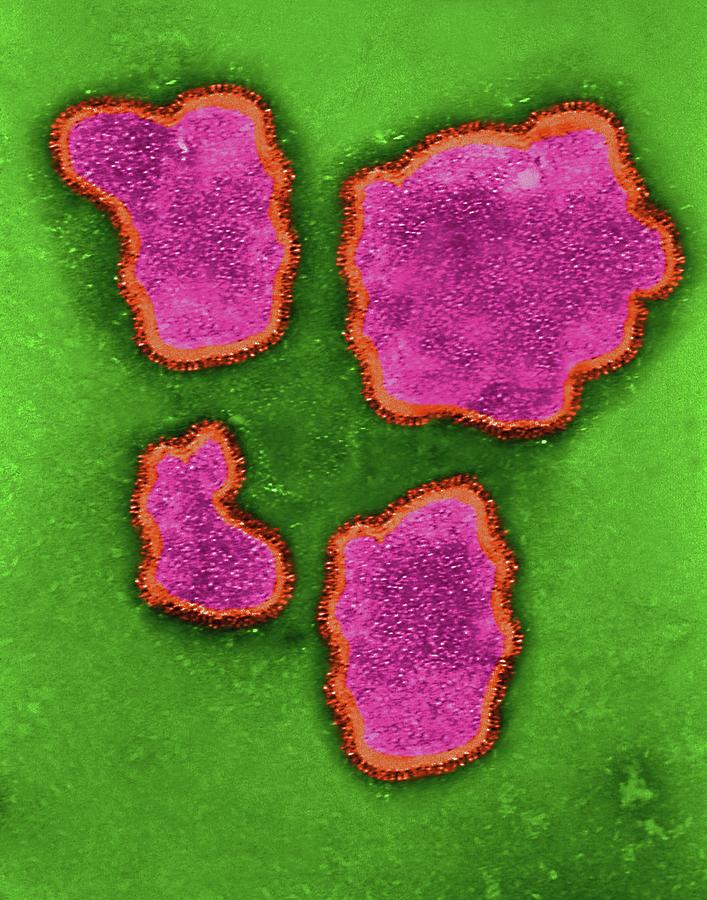 Respiratory Syncytial Virus Photograph by Dennis Kunkel Microscopy/science Photo Library