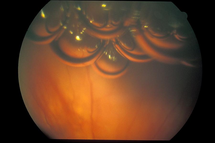 retina art or the unretina art retina art or the unretina art
