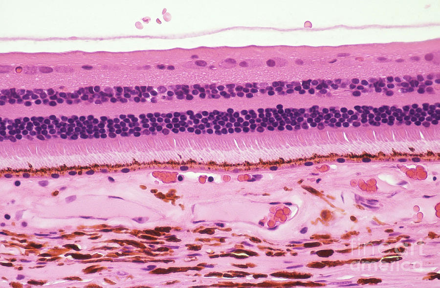 Retina And Choroid, Lm Photograph by Ralph C. Eagle, Jr.