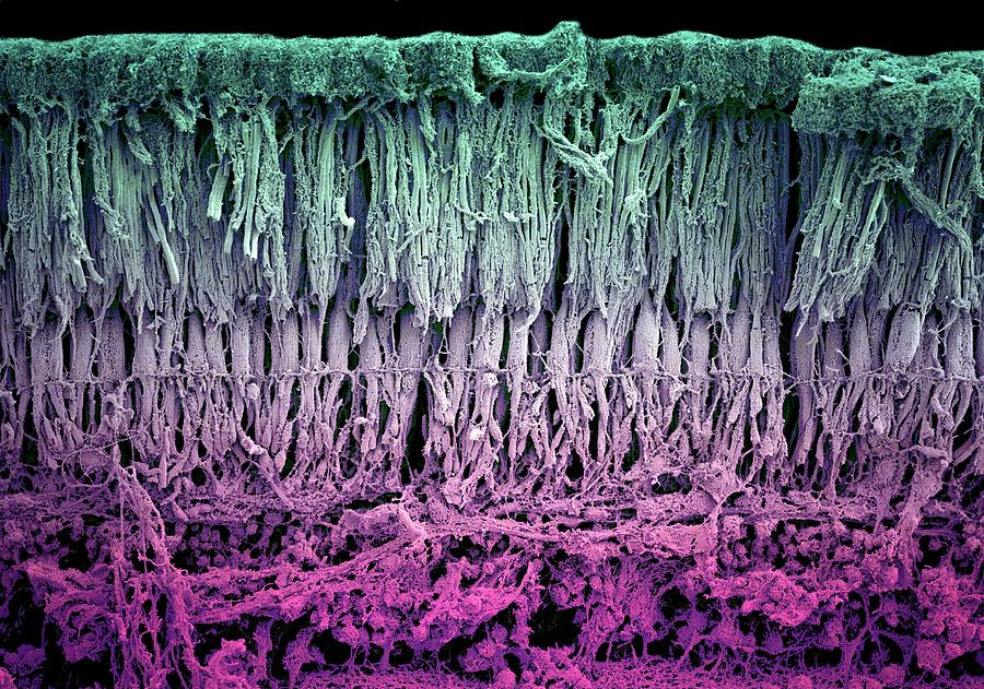 Retina Layers Photograph by Louise Hughes/science Photo Library