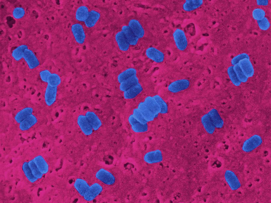 Rhabdovirus Photograph by Dennis Kunkel Microscopy/science Photo Library