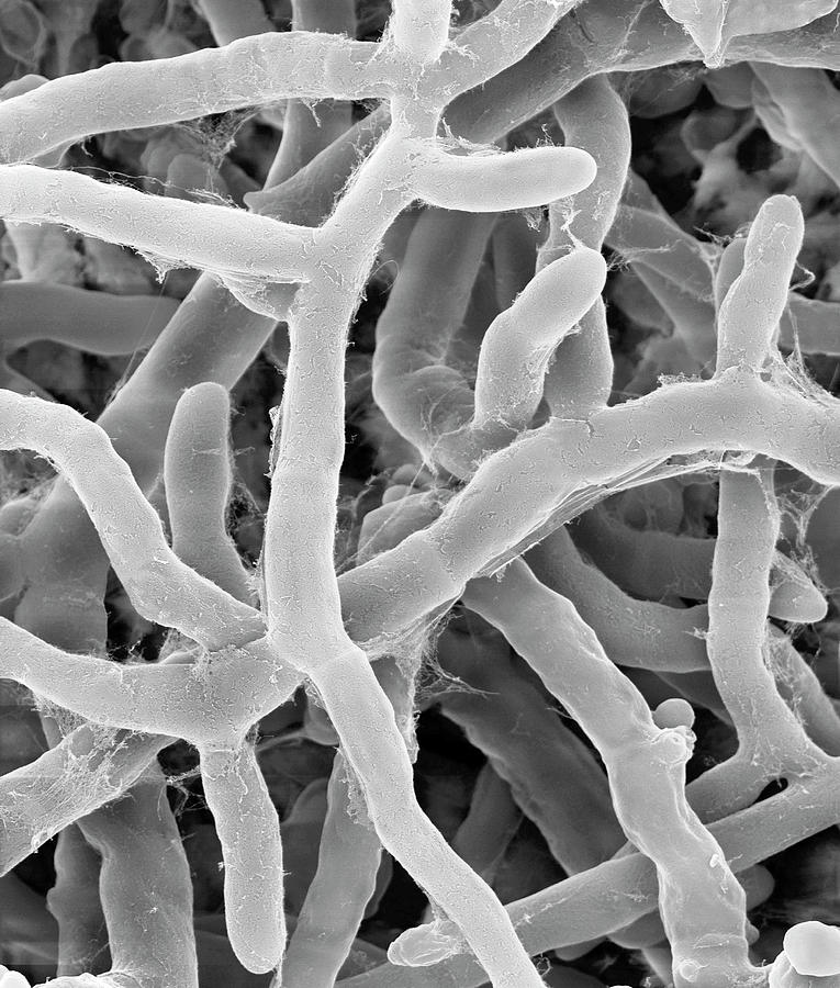 Rhizoctonia Solani Pathogenic Plant Fungus Photograph by Dennis Kunkel Microscopy/science Photo Library