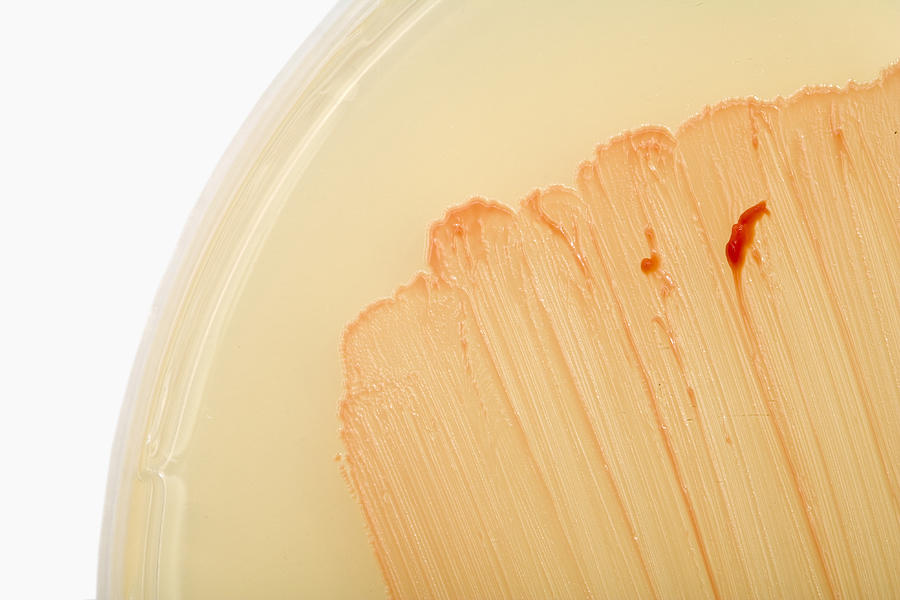 Rhodococcus Rhodochrous Culture Photograph by Science Stock Photography